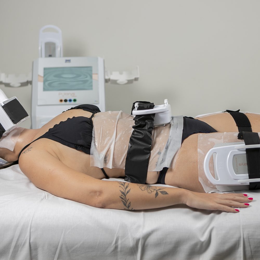 criolipolise_de_placas_harmonizacao_corporal_gordura_localizada_estetica_ibramed (1)